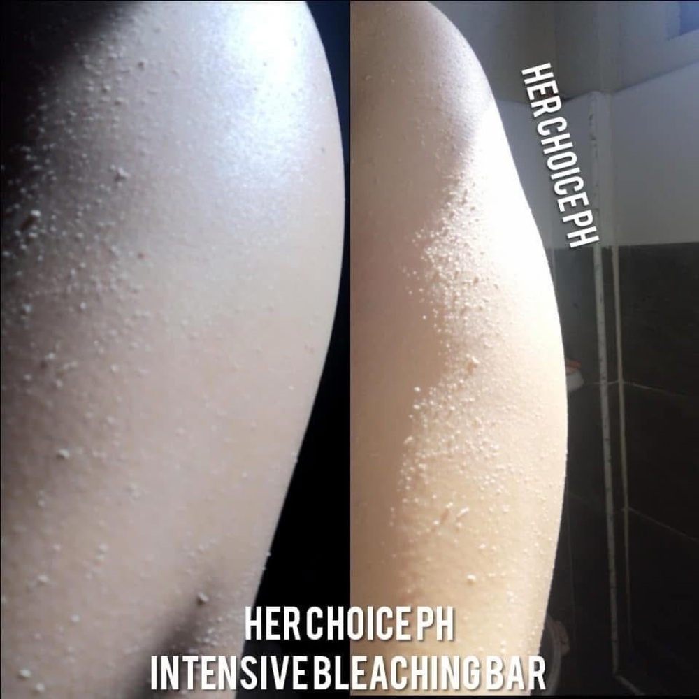 HER Choice Ph INTENSE BLEACHING BAR SOAP. - Picture 8 of 15